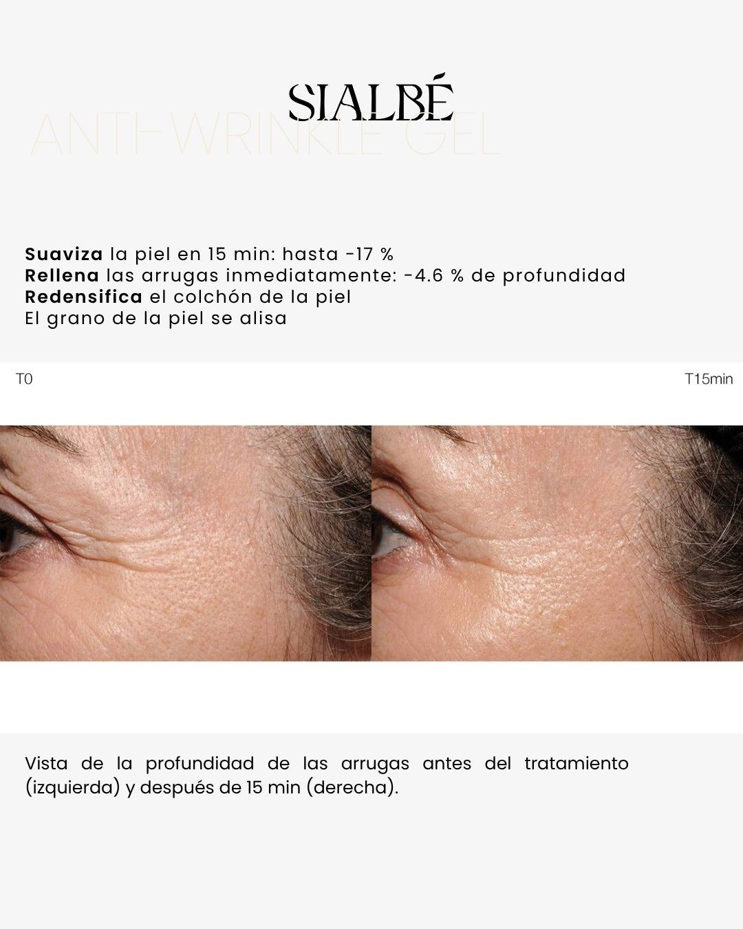 ANTI-WRINKLE GEL